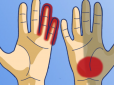 Слідкуйте за своїми долонями! ТОП-7 хвороб, про які попереджають наші руки